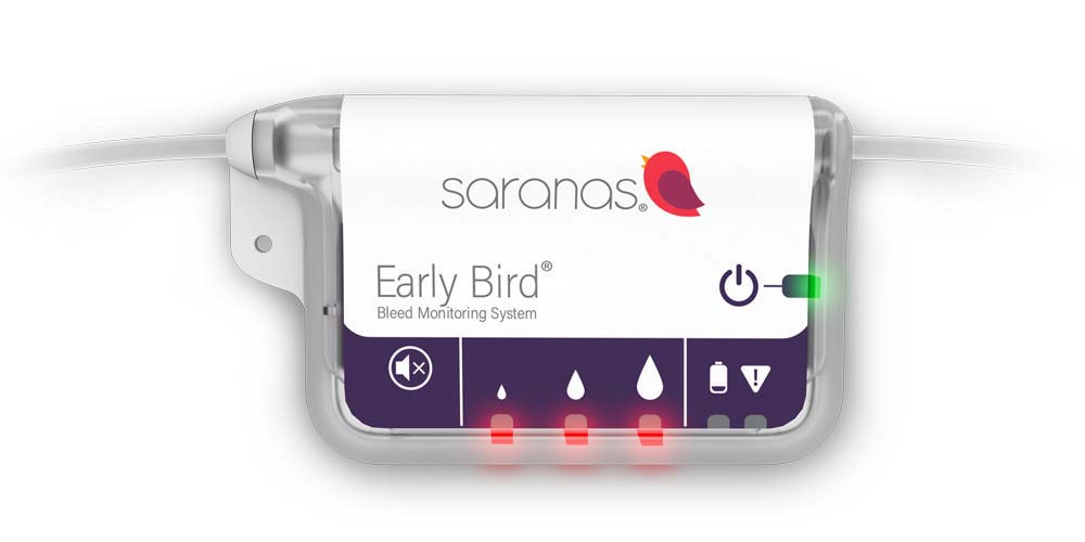 Imagen: El sistema de monitoreo de sangrado Early Bird proporciona indicadores visuales y audibles del inicio y la progresión de los eventos de sangrado (Fotografía cortesía de Saranas)